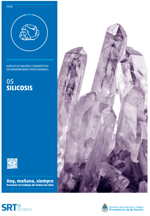 Silicosis